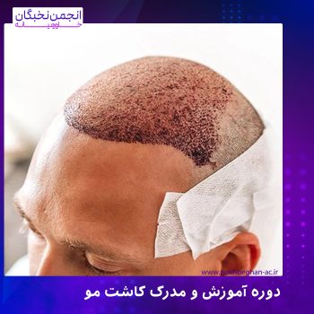 دوره و مدرک کاشت مو