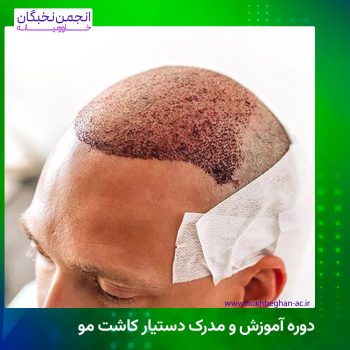 دوره آموزش و مدرک دستیار کاشت مو